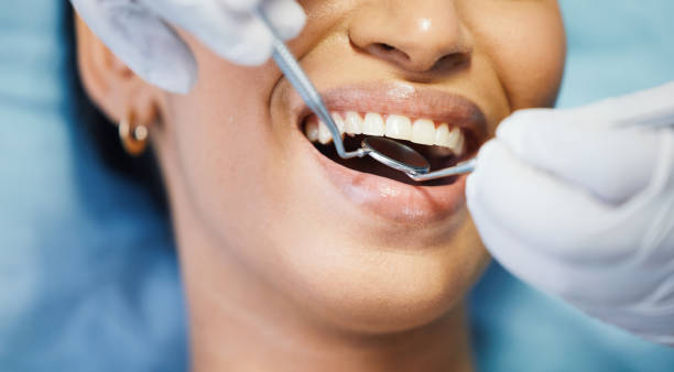 Best Root Canal Emergency Dentist  in Colwyn, PA